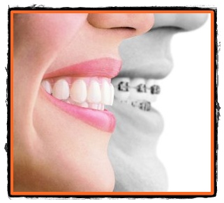 Ortodontia indreptarea si corectarea pozitiei dintilor